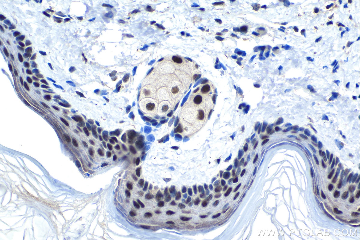 Immunohistochemical analysis of paraffin-embedded mouse skin tissue slide using KHC1485 (SUPT7L IHC Kit).