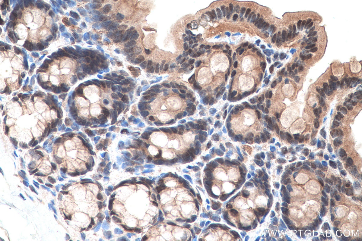 Immunohistochemical analysis of paraffin-embedded rat colon tissue slide using KHC0646 (SURVIVIN IHC Kit).