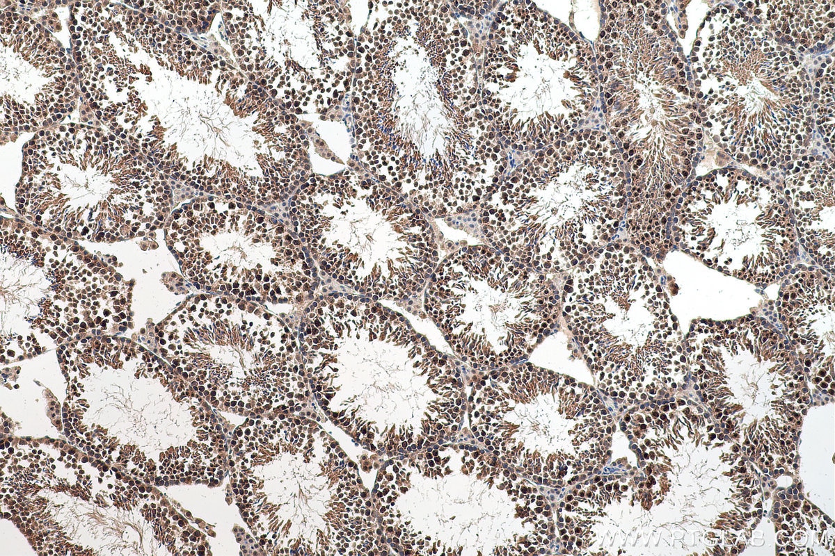 Immunohistochemical analysis of paraffin-embedded mouse testis tissue slide using KHC0646 (SURVIVIN IHC Kit).