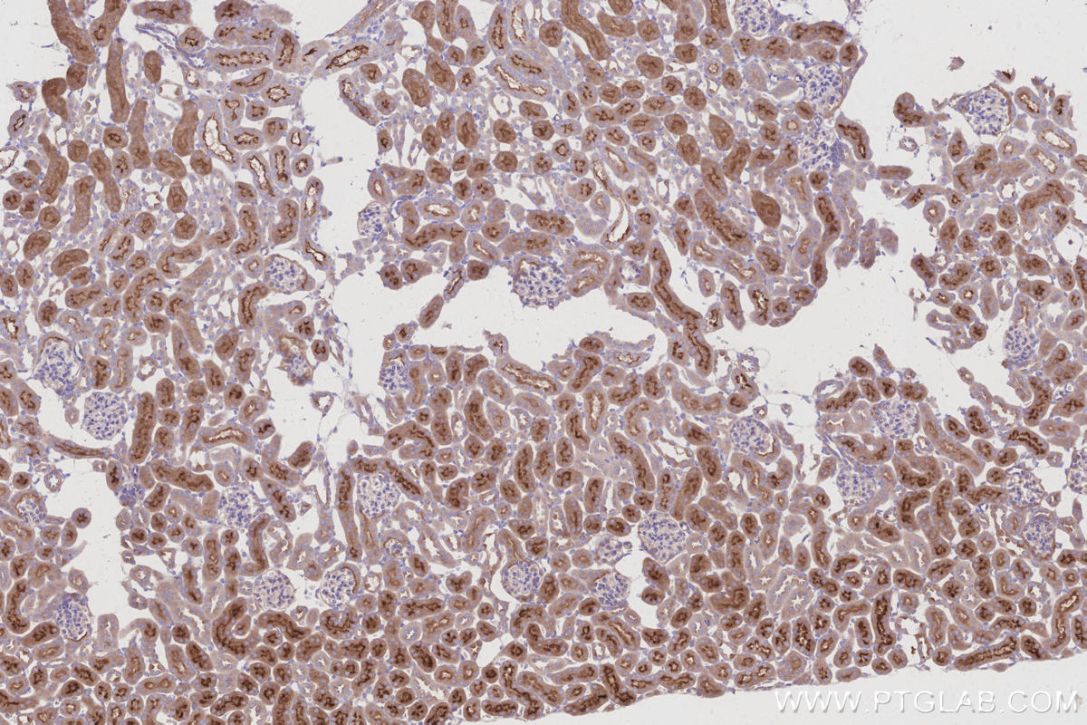 Immunohistochemical analysis of paraffin-embedded mouse kidney tissue slide using KHC3005 (SUSD2 IHC Kit). Immunohistochemical analysis of paraffin-embedded mouse kidney tissue slide using KHC3005 (SUSD2 IHC Kit).