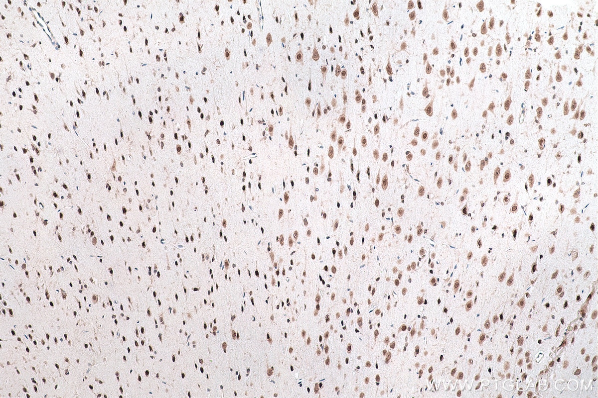 Immunohistochemical analysis of paraffin-embedded rat brain tissue slide using KHC0883 (SYNCRIP IHC Kit).