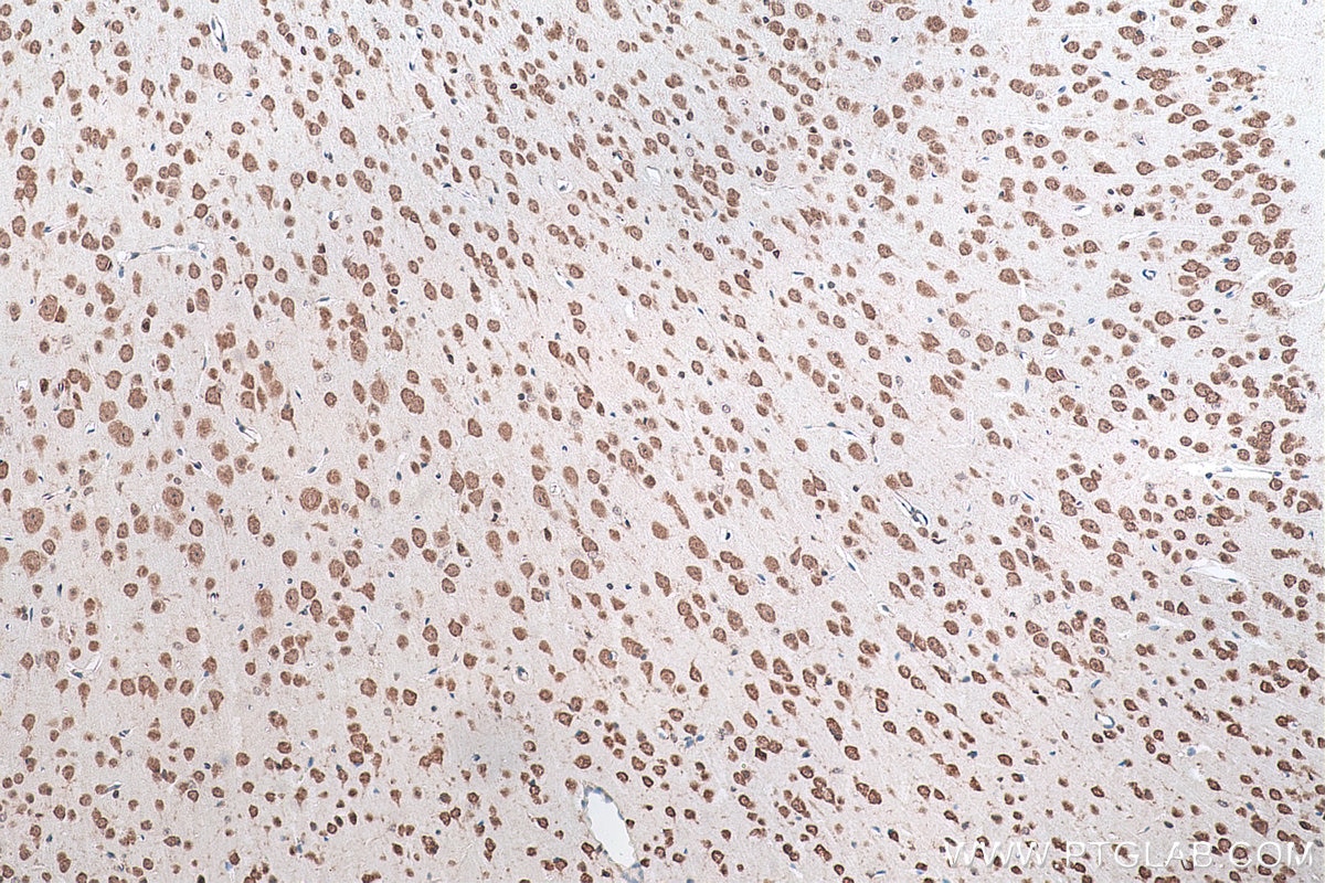 Immunohistochemical analysis of paraffin-embedded mouse brain tissue slide using KHC0883 (SYNCRIP IHC Kit).