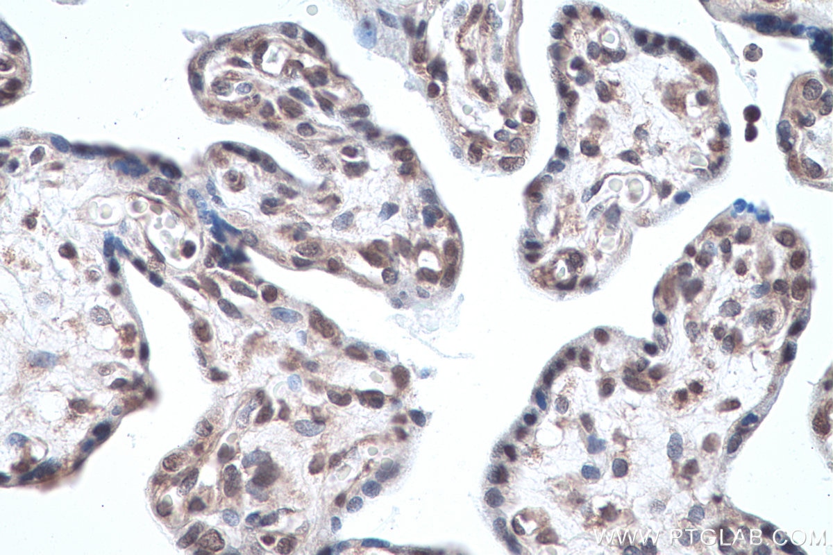 Immunohistochemical analysis of paraffin-embedded human placenta tissue slide using KHC0883 (SYNCRIP IHC Kit).