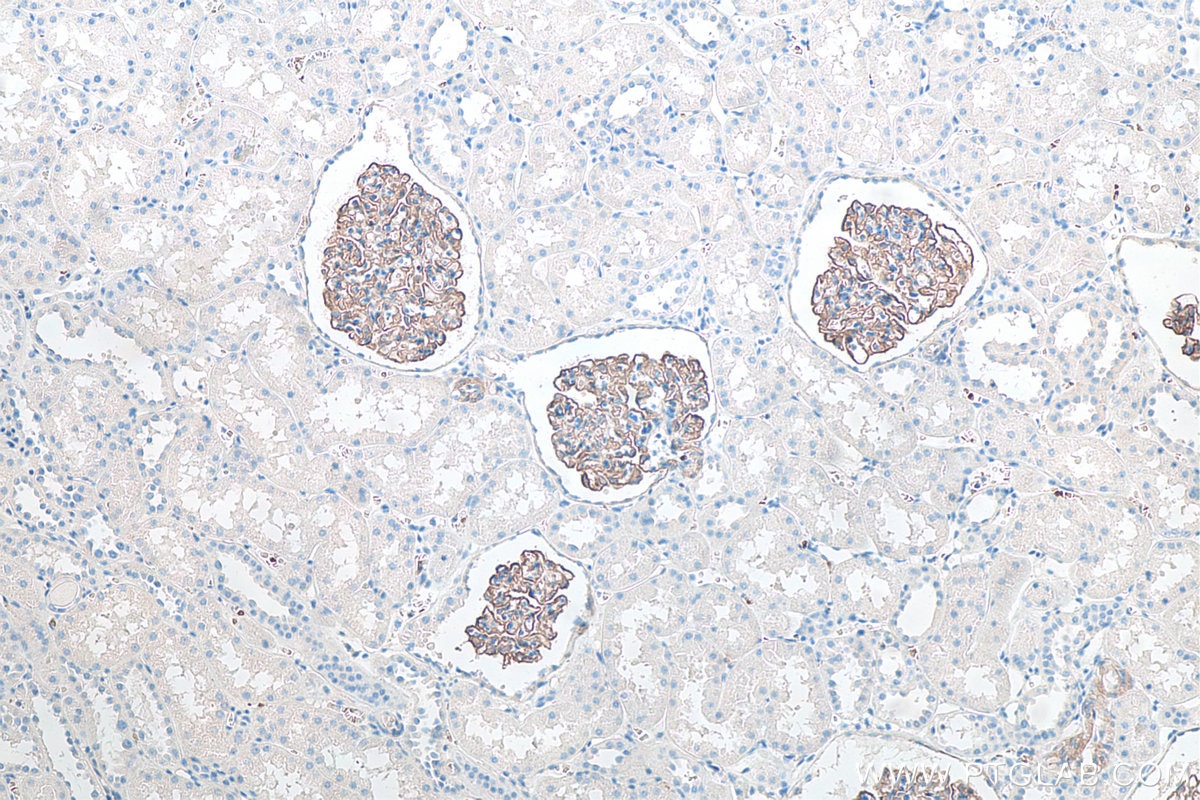 Immunohistochemical analysis of paraffin-embedded human kidney tissue slide using KHC0098 (SYNPO IHC Kit).