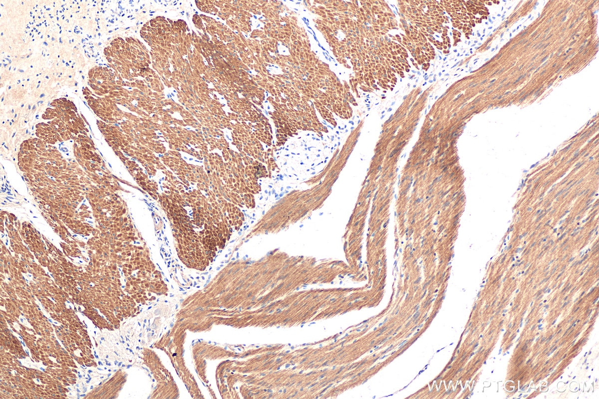 Immunohistochemical analysis of paraffin-embedded human small intestine tissue slide using KHC0597 (Smoothelin/SMTN IHC Kit).