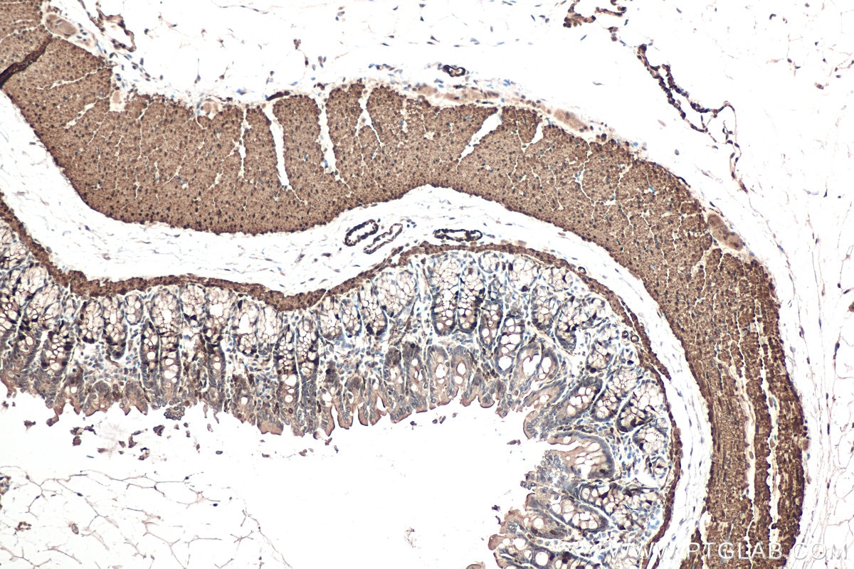 Immunohistochemical analysis of paraffin-embedded rat colon tissue slide using KHC0597 (Smoothelin/SMTN IHC Kit).