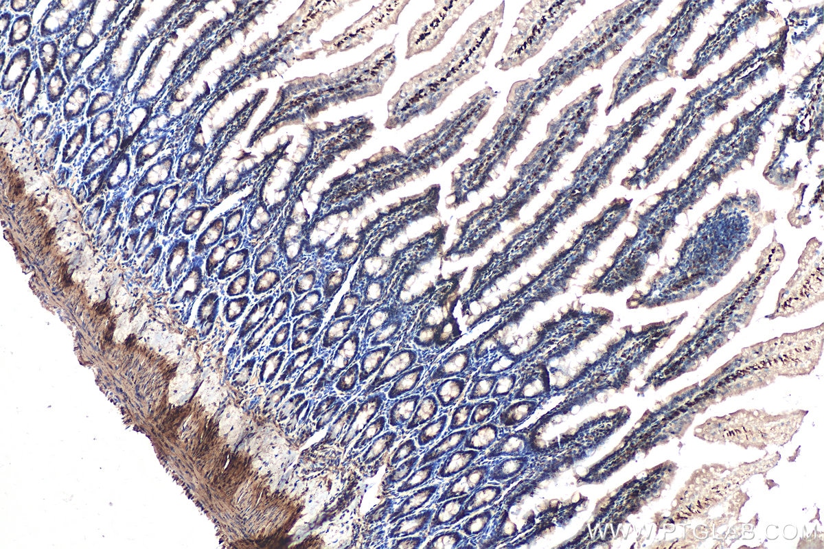 Immunohistochemical analysis of paraffin-embedded rat small intestine tissue slide using KHC0597 (Smoothelin/SMTN IHC Kit).