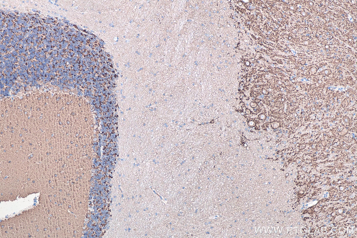 Immunohistochemical analysis of paraffin-embedded rat cerebellum tissue slide using KHC0059 (Synaptophysin IHC Kit).