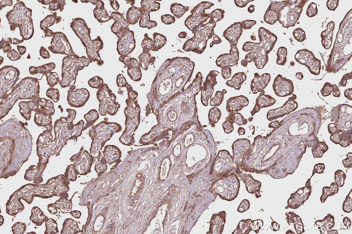 Immunohistochemical analysis of paraffin-embedded human placenta tissue slide using KHC2801 (Syndetin/CCDC132 IHC Kit).