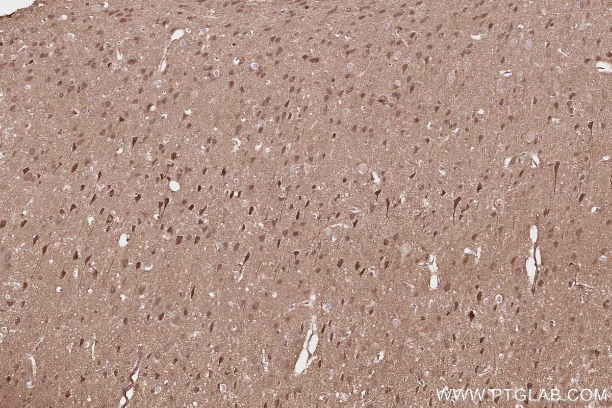 Immunohistochemical analysis of paraffin-embedded mouse brain tissue slide using KHC2801 (Syndetin/CCDC132 IHC Kit).