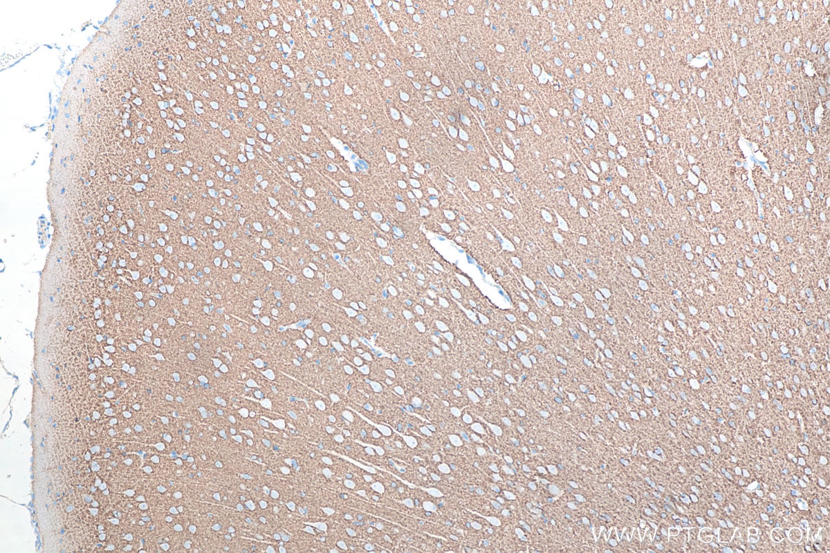 Immunohistochemical analysis of paraffin-embedded rat brain tissue slide using KHC0051 (Syntaxin 1A/1B IHC Kit).