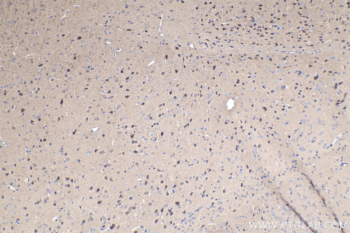 Immunohistochemical analysis of paraffin-embedded mouse brain tissue slide using KHC1101 (TAC1 IHC Kit).