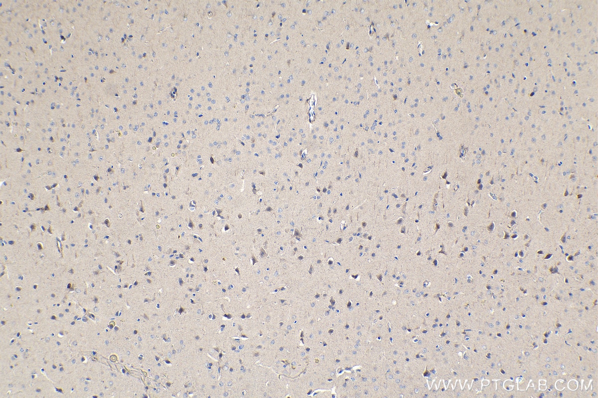 Immunohistochemical analysis of paraffin-embedded rat brain tissue slide using KHC1101 (TAC1 IHC Kit).