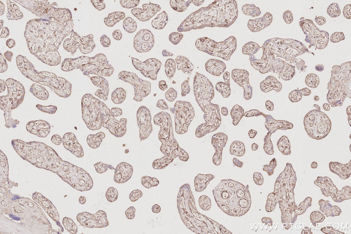 Immunohistochemical analysis of paraffin-embedded human placenta tissue slide using KHC3086 (TACC3 IHC Kit). Immunohistochemical analysis of paraffin-embedded human placenta tissue slide using KHC3086 (TACC3 IHC Kit).