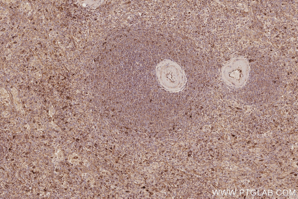 Immunohistochemical analysis of paraffin-embedded human spleen tissue slide using KHC3086 (TACC3 IHC Kit). Immunohistochemical analysis of paraffin-embedded human spleen tissue slide using KHC3086 (TACC3 IHC Kit).
