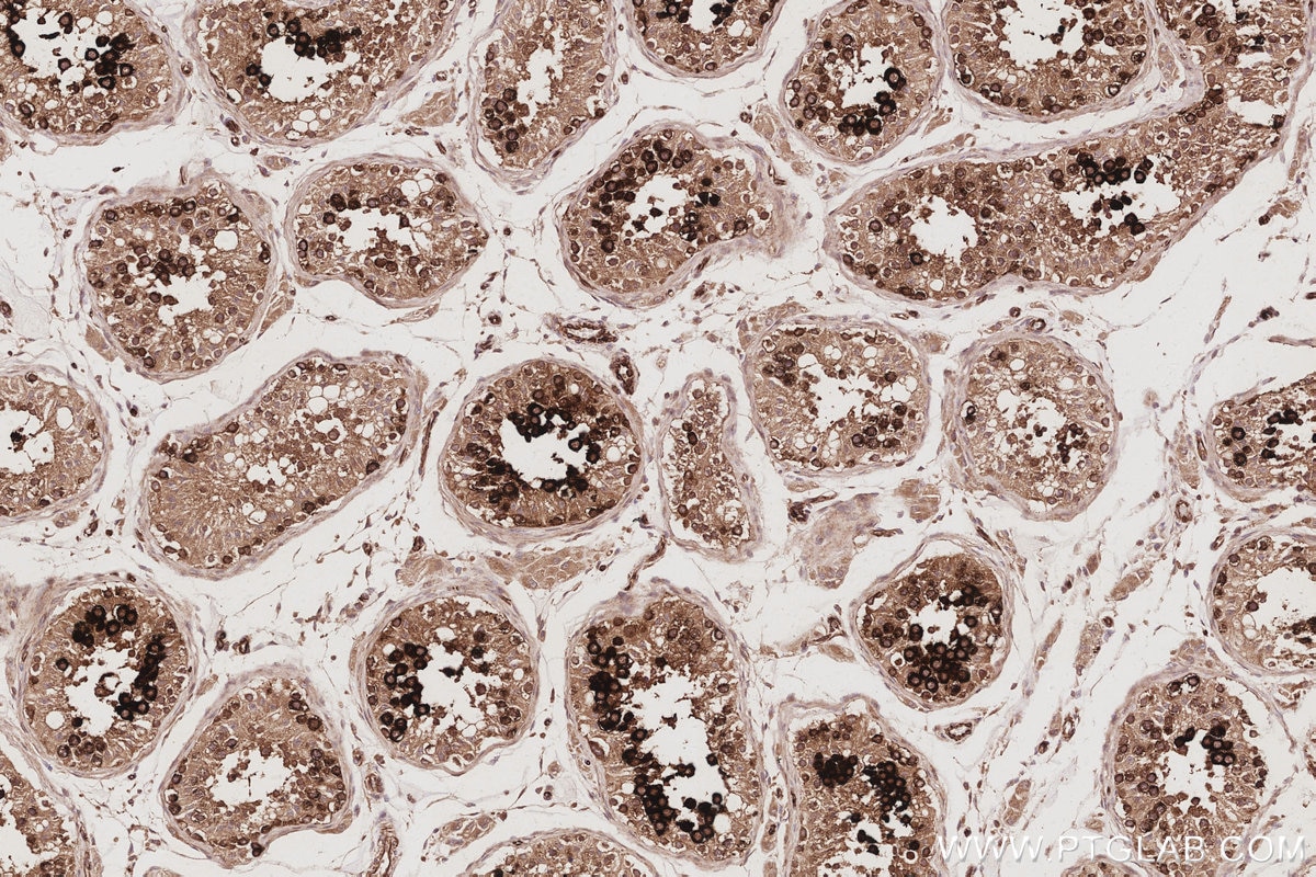 Immunohistochemical analysis of paraffin-embedded human testis tissue slide using KHC3086 (TACC3 IHC Kit). Immunohistochemical analysis of paraffin-embedded human testis tissue slide using KHC3086 (TACC3 IHC Kit).