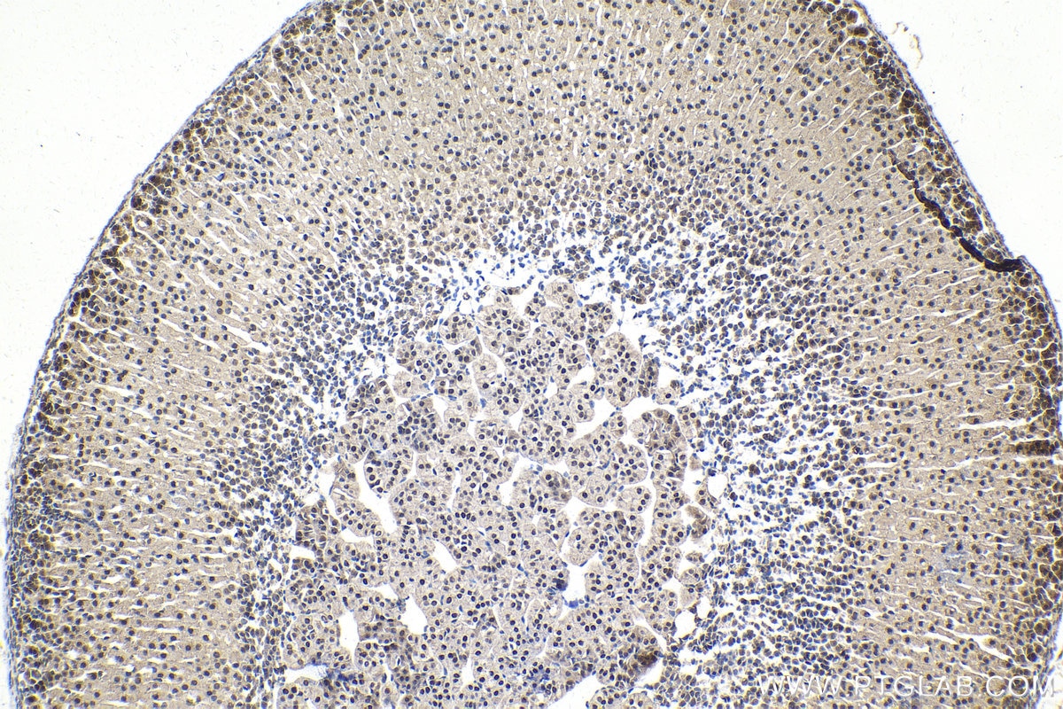 Immunohistochemical analysis of paraffin-embedded mouse adrenal gland tissue slide using KHC1476 (TADA3L IHC Kit).
