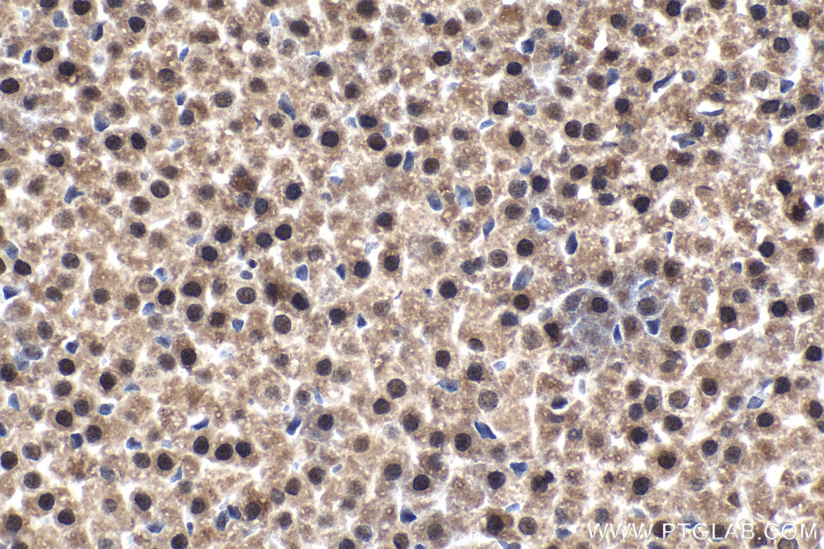 Immunohistochemical analysis of paraffin-embedded rat adrenal gland tissue slide using KHC1476 (TADA3L IHC Kit).