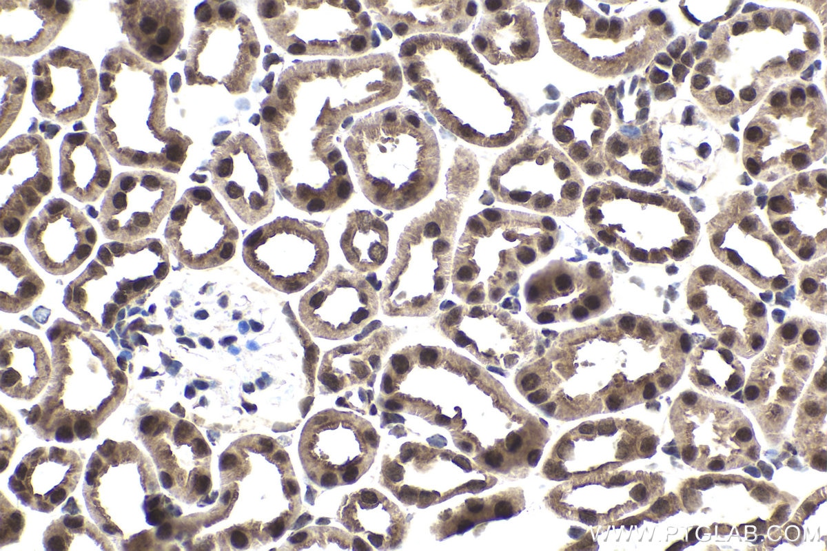 Immunohistochemical analysis of paraffin-embedded mouse kidney tissue slide using KHC1858 (TAF15 IHC Kit).