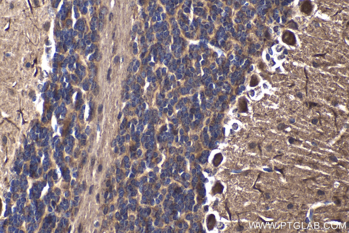 Immunohistochemical analysis of paraffin-embedded mouse cerebellum tissue slide using KHC1858 (TAF15 IHC Kit).