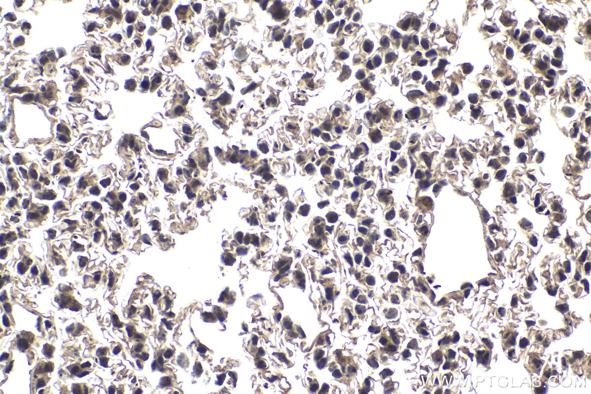 Immunohistochemical analysis of paraffin-embedded mouse lung tissue slide using KHC1754 (TAF7 IHC Kit).