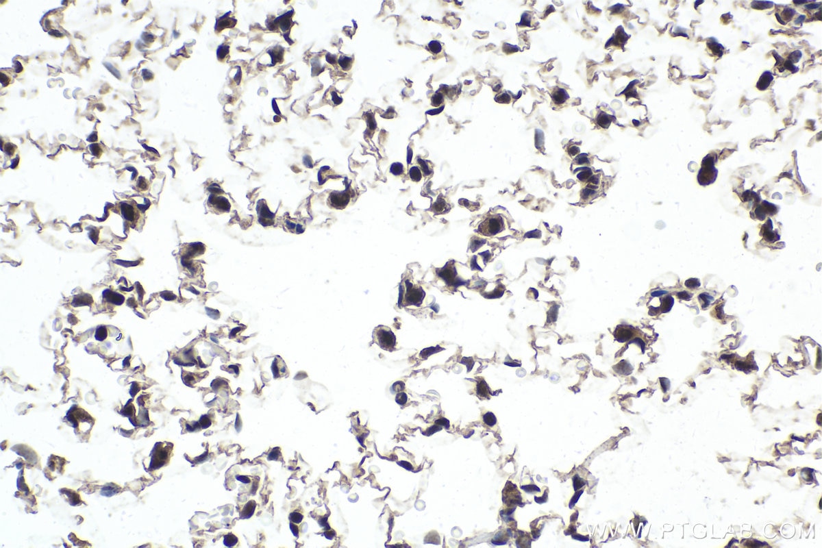 Immunohistochemical analysis of paraffin-embedded rat lung tissue slide using KHC1754 (TAF7 IHC Kit).