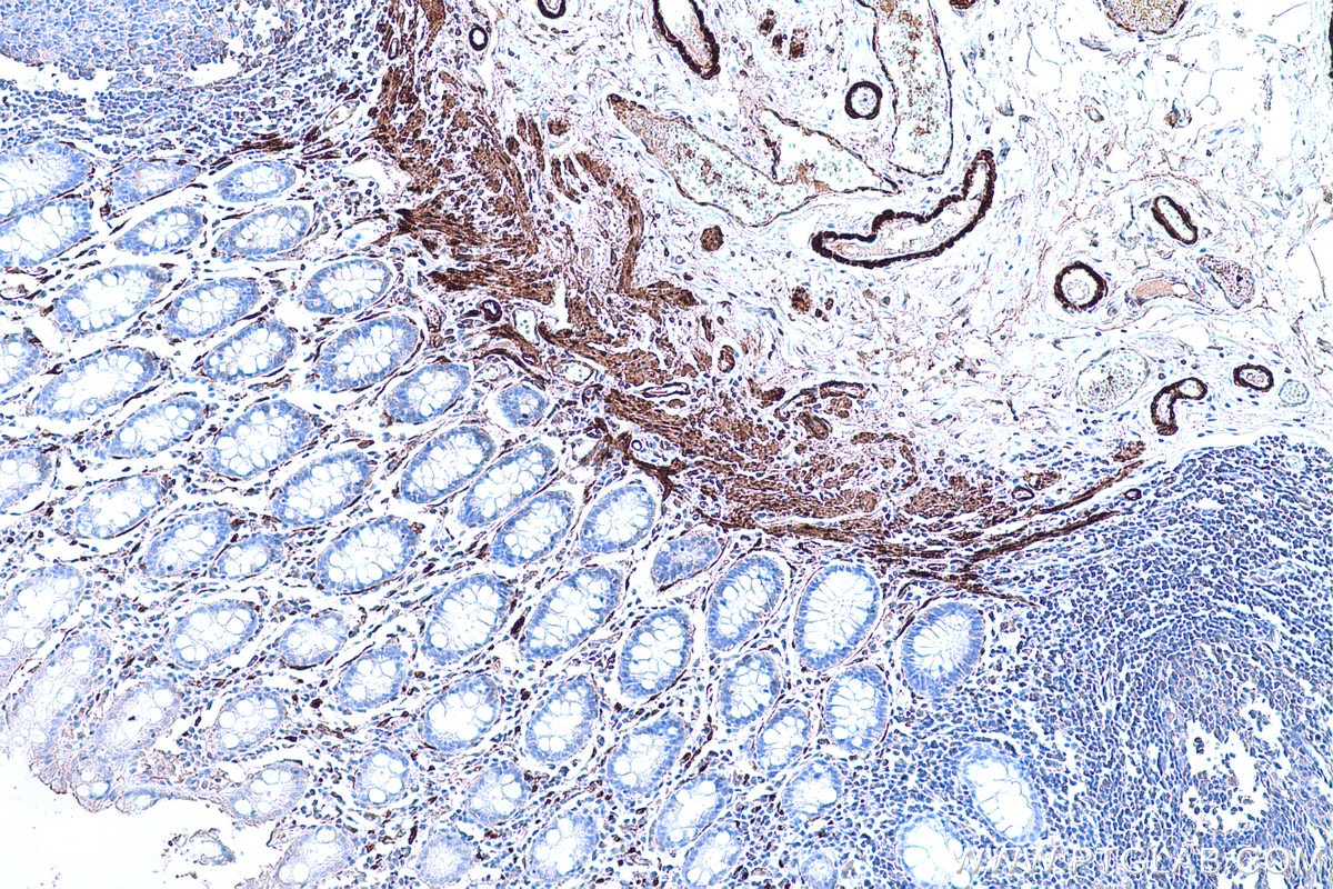 Immunohistochemical analysis of paraffin-embedded human colon tissue slide using KHC0652 (TAGLN IHC Kit).