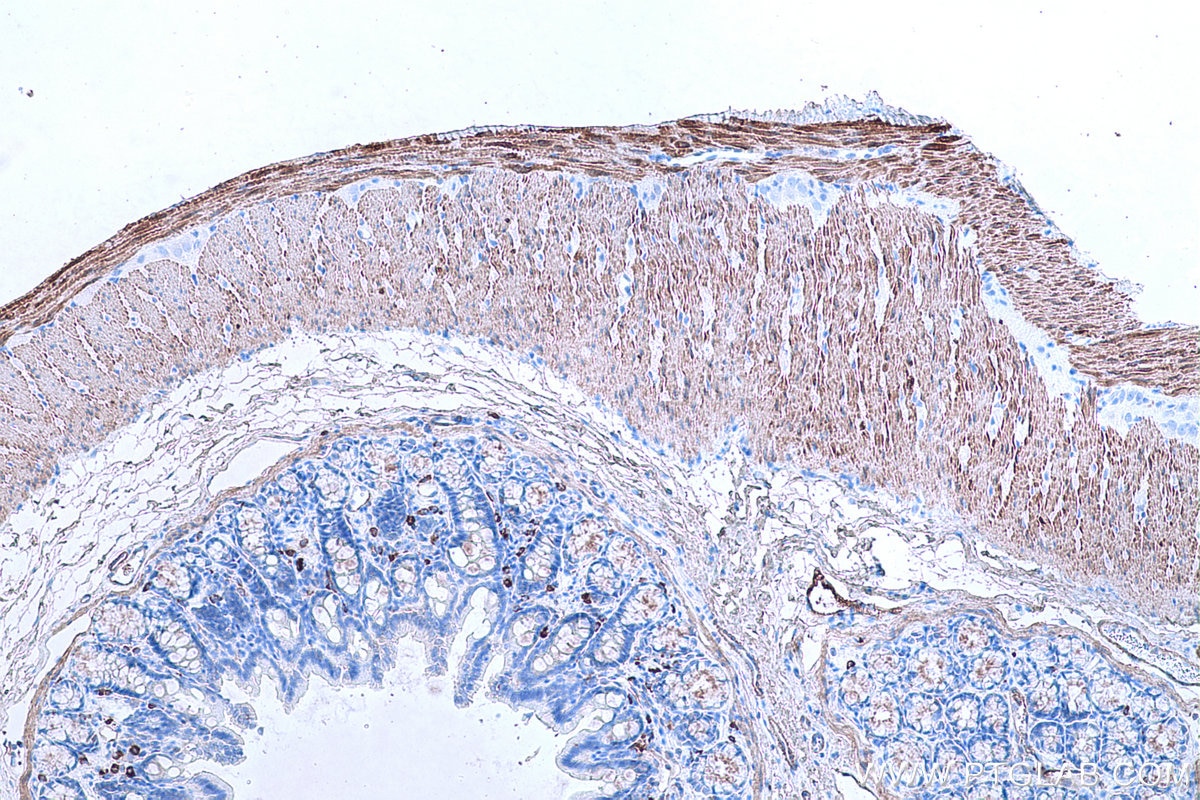 Immunohistochemical analysis of paraffin-embedded rat colon tissue slide using KHC0652 (TAGLN IHC Kit).