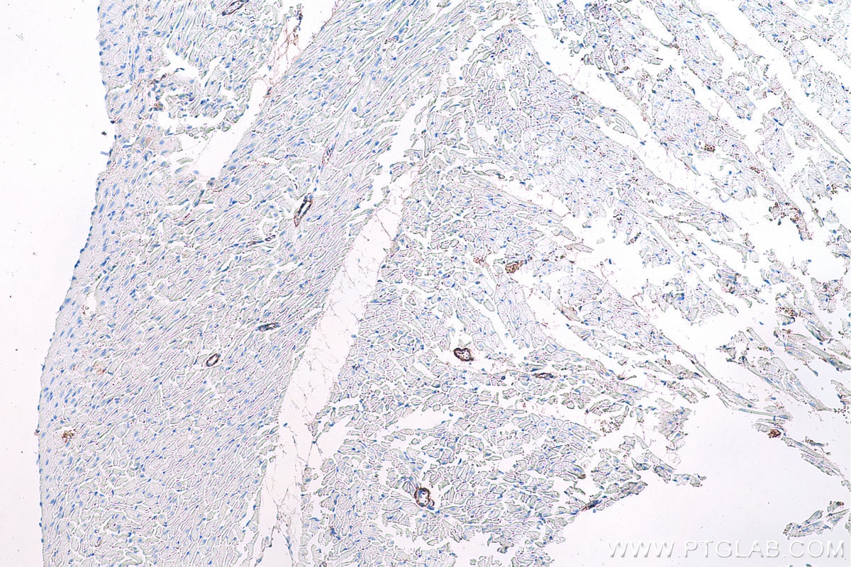 Immunohistochemical analysis of paraffin-embedded rat heart tissue slide using KHC0652 (TAGLN IHC Kit).