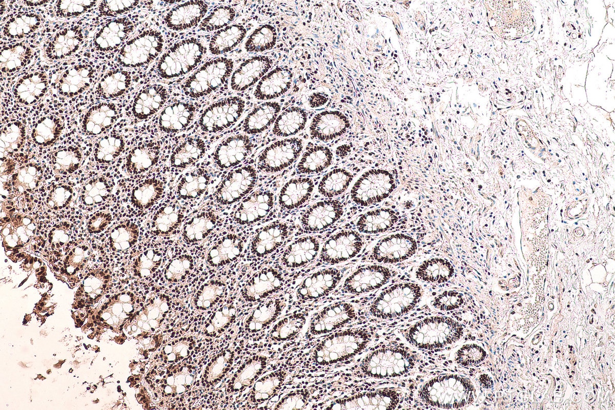 Immunohistochemical analysis of paraffin-embedded human colon tissue slide using KHC0714 (TALDO1 IHC Kit).