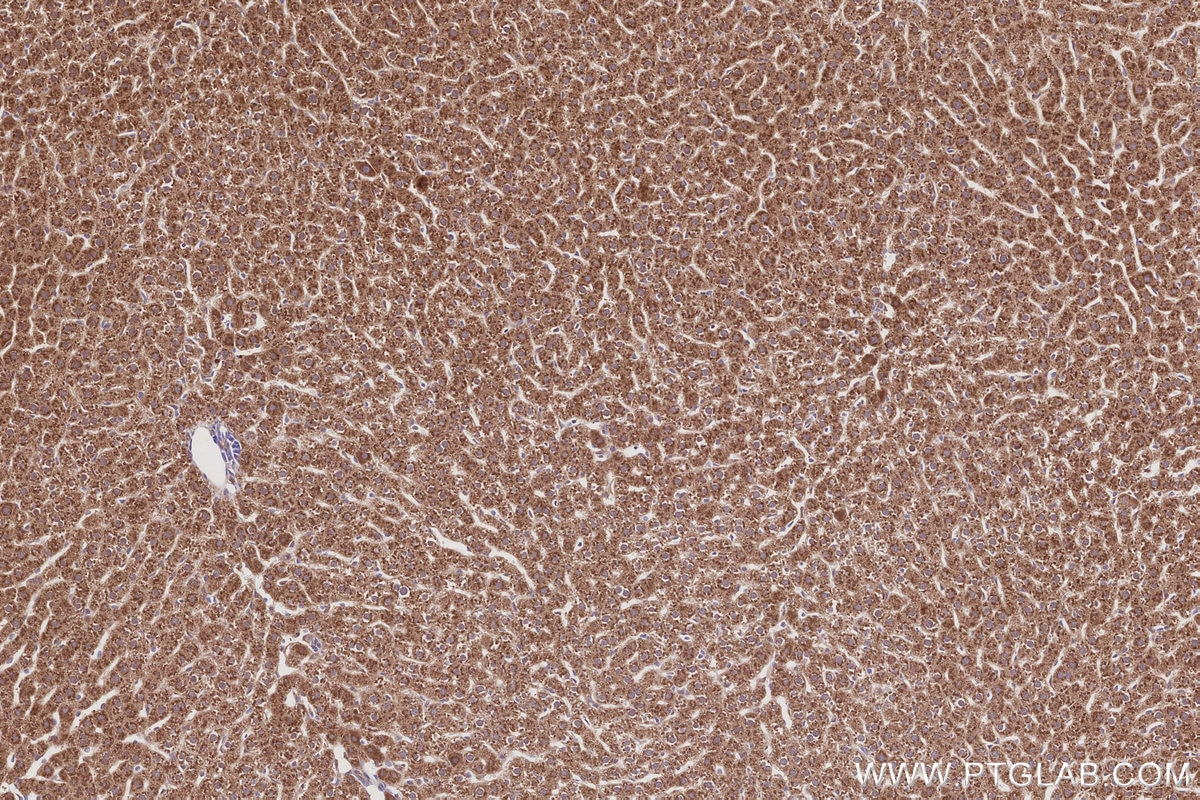 Immunohistochemical analysis of paraffin-embedded rat liver tissue slide using KHC3031 (TAOK2 IHC Kit).