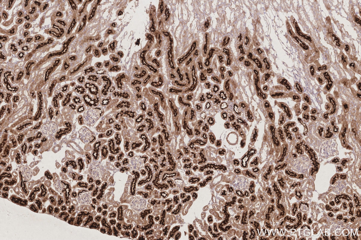 Immunohistochemical analysis of paraffin-embedded mouse kidney tissue slide using KHC2908 (TAOK3 IHC Kit).