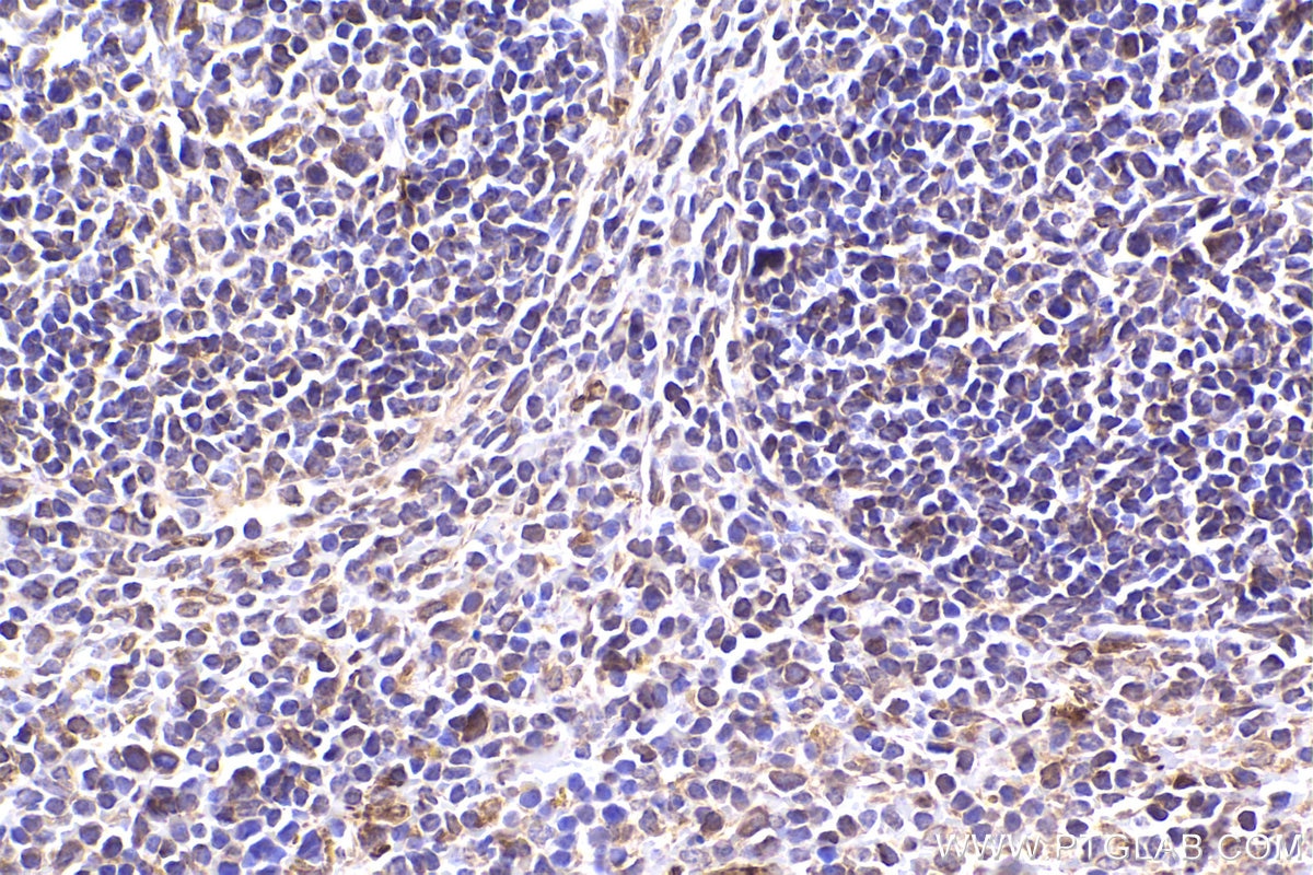 Immunohistochemical analysis of paraffin-embedded mouse spleen tissue slide using KHC2390 (TAP1 IHC Kit).