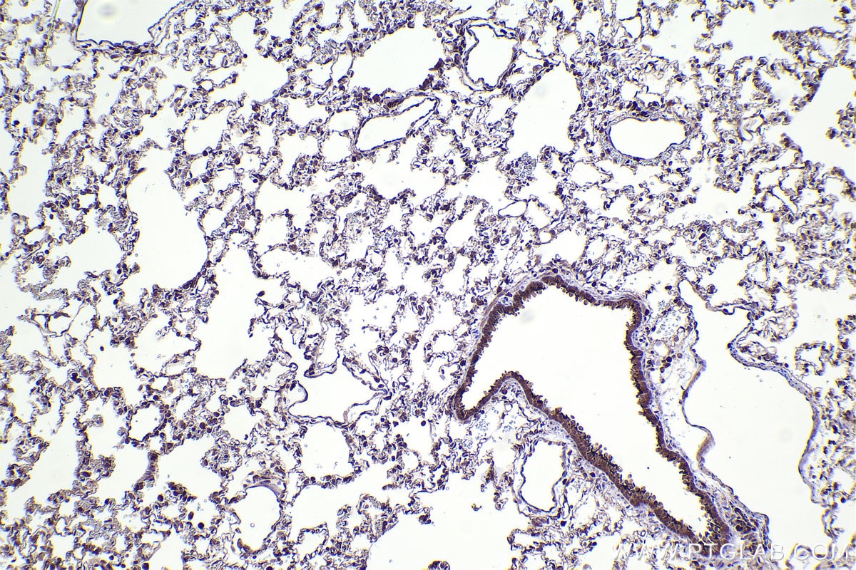 Immunohistochemical analysis of paraffin-embedded rat lung tissue slide using KHC2390 (TAP1 IHC Kit).