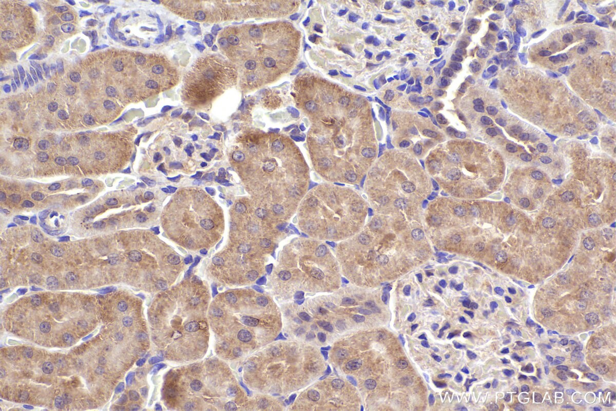 Immunohistochemical analysis of paraffin-embedded rat kidney tissue slide using KHC2391 (TAP2 IHC Kit).