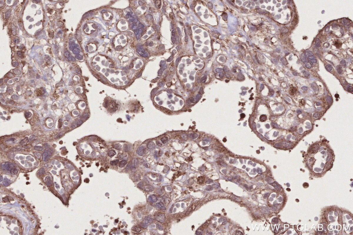 Immunohistochemical analysis of paraffin-embedded human placenta tissue slide using KHC2711 (TBC1D15 IHC Kit).