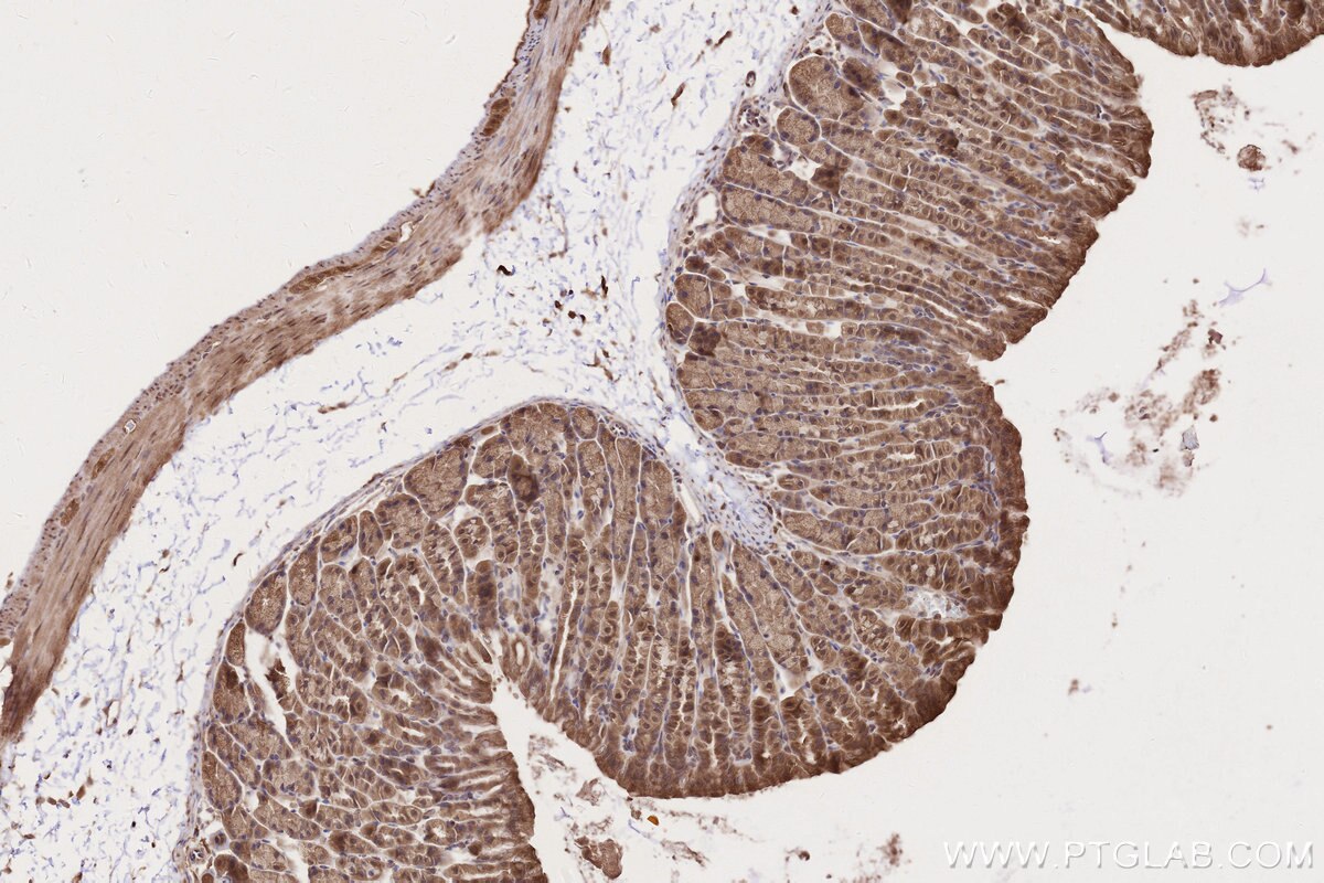 Immunohistochemical analysis of paraffin-embedded mouse stomach tissue slide using KHC2748 (TBC1D5 IHC Kit).