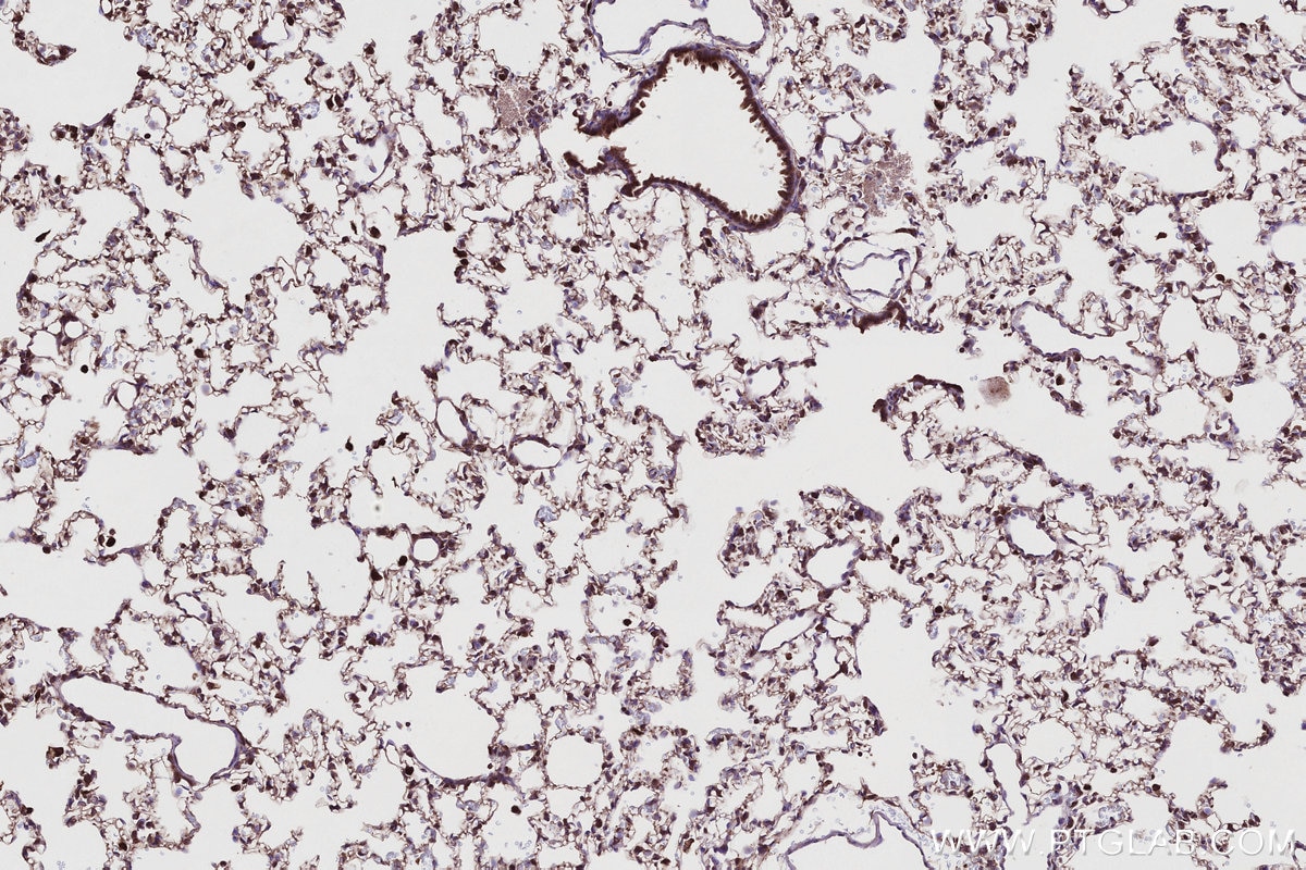 Immunohistochemical analysis of paraffin-embedded rat lung tissue slide using KHC2748 (TBC1D5 IHC Kit).