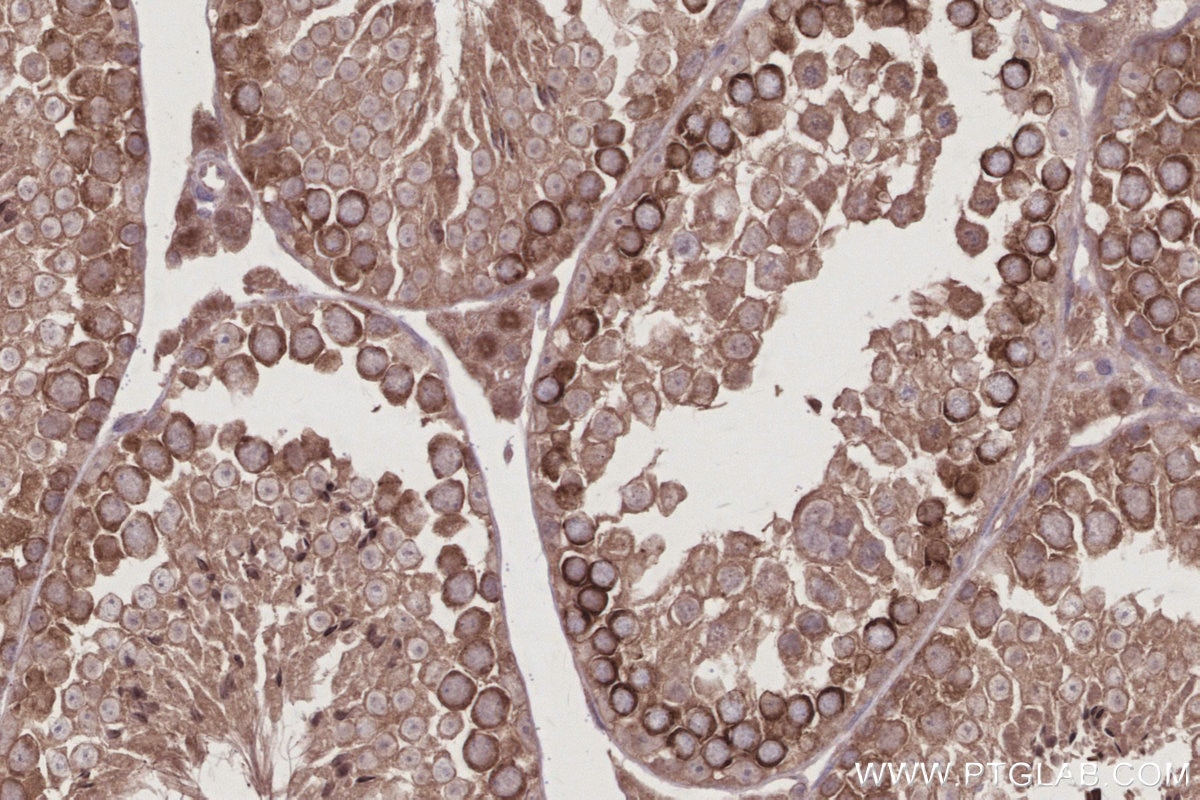 Immunohistochemical analysis of paraffin-embedded mouse testis tissue slide using KHC3008 (TBK1 IHC Kit).