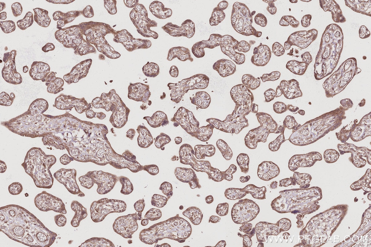 Immunohistochemical analysis of paraffin-embedded human placenta tissue slide using KHC3008 (TBK1 IHC Kit).