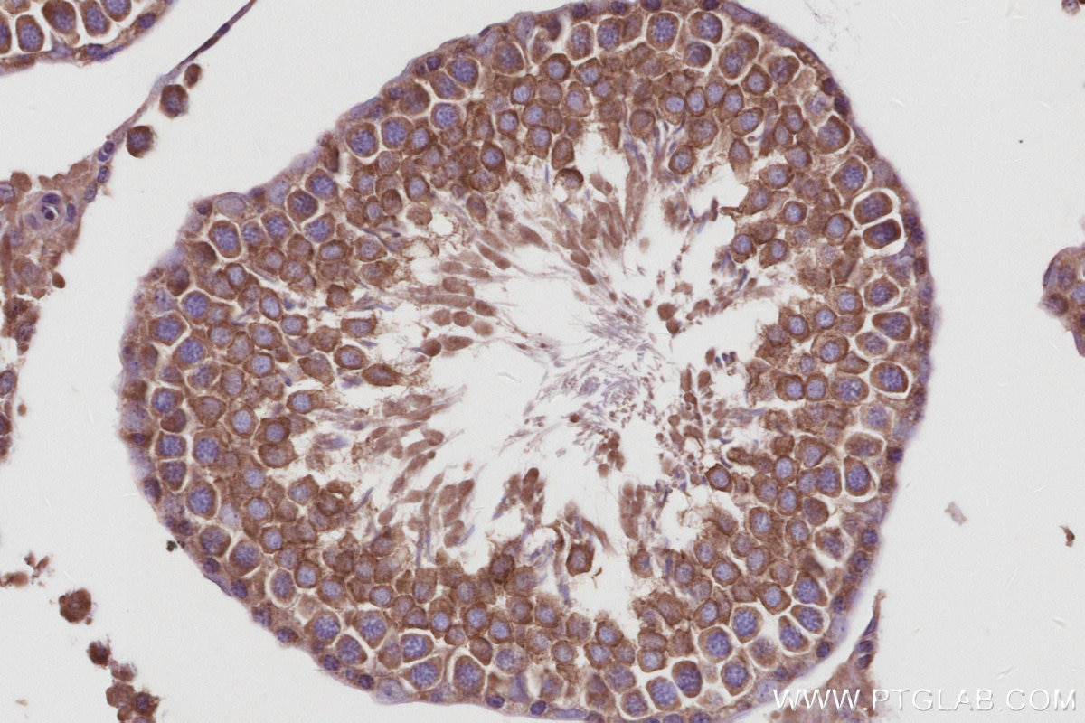 Immunohistochemical analysis of paraffin-embedded rat testis tissue slide using KHC3008 (TBK1 IHC Kit).