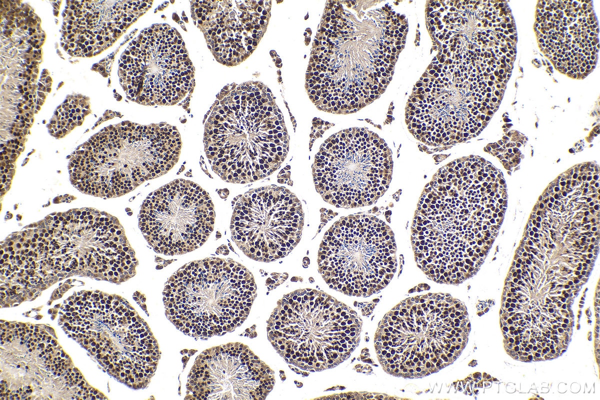 Immunohistochemical analysis of paraffin-embedded mouse testis tissue slide using KHC1647 (TBPL1 IHC Kit).