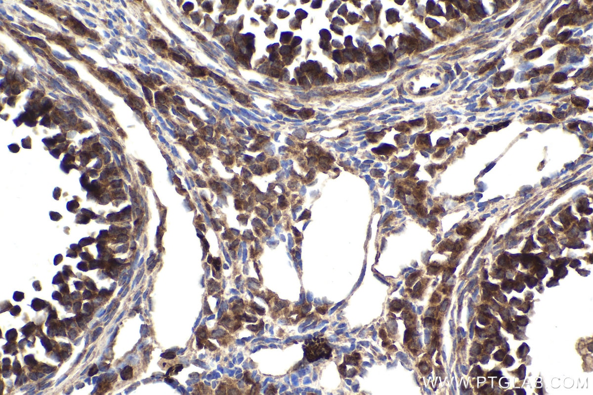 Immunohistochemical analysis of paraffin-embedded mouse ovary tissue slide using KHC1893 (TBX5 IHC Kit).