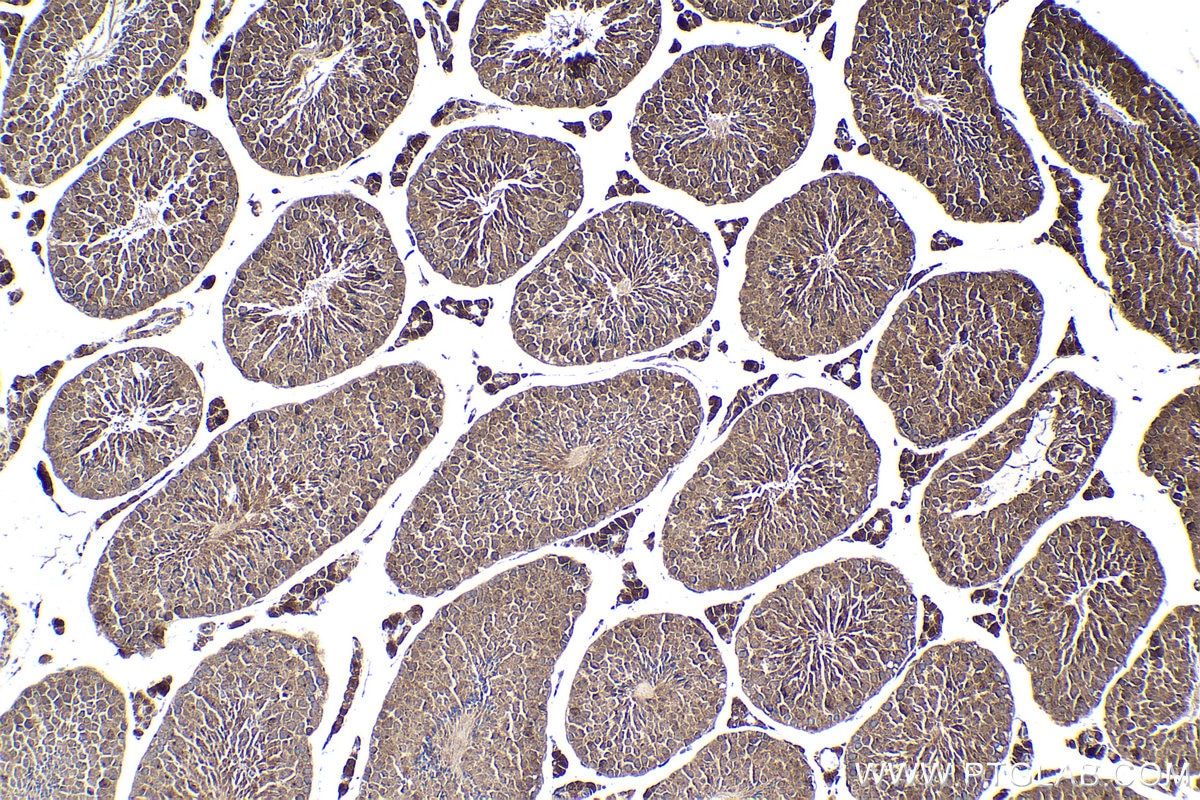 Immunohistochemical analysis of paraffin-embedded mouse testis tissue slide using KHC1893 (TBX5 IHC Kit).