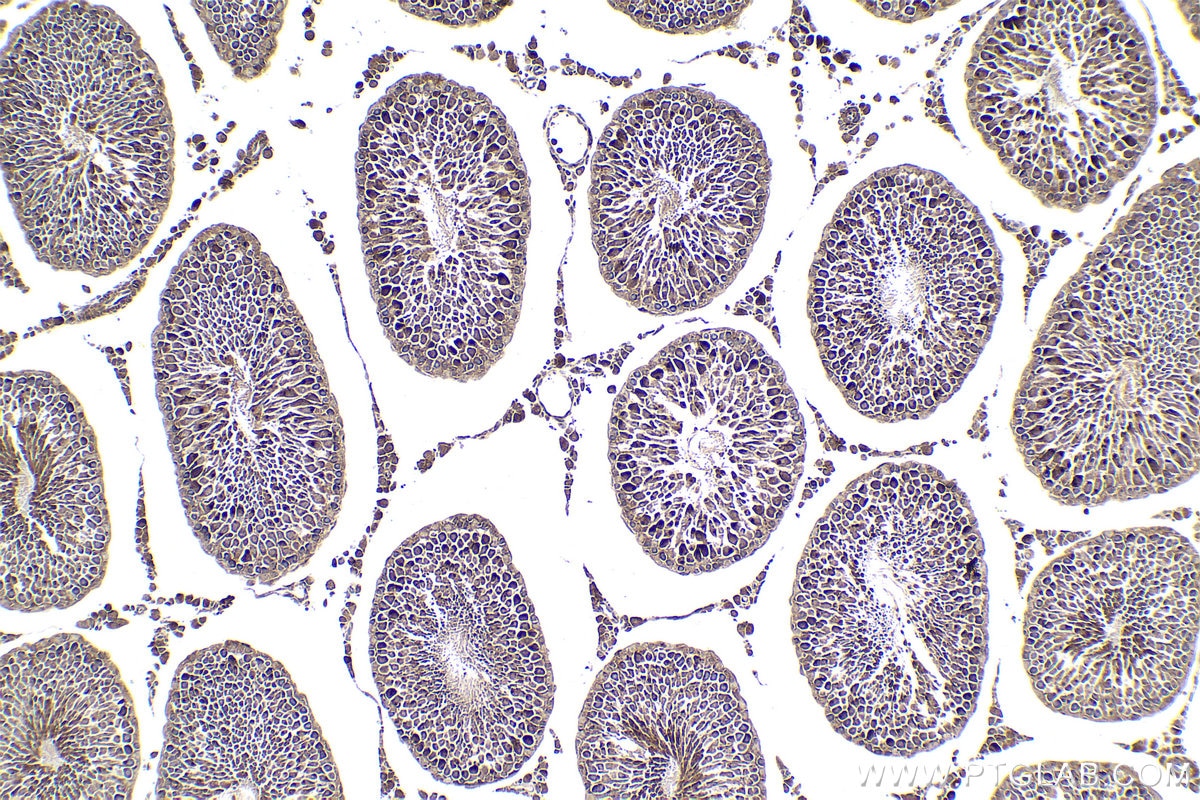 Immunohistochemical analysis of paraffin-embedded rat testis tissue slide using KHC1893 (TBX5 IHC Kit).