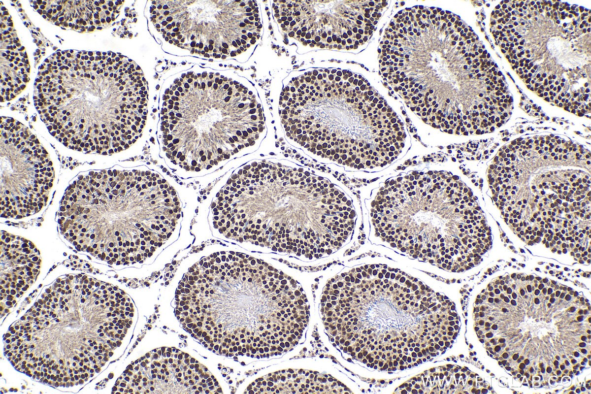 Immunohistochemical analysis of paraffin-embedded rat testis tissue slide using KHC1428 (TCERG1 IHC Kit).