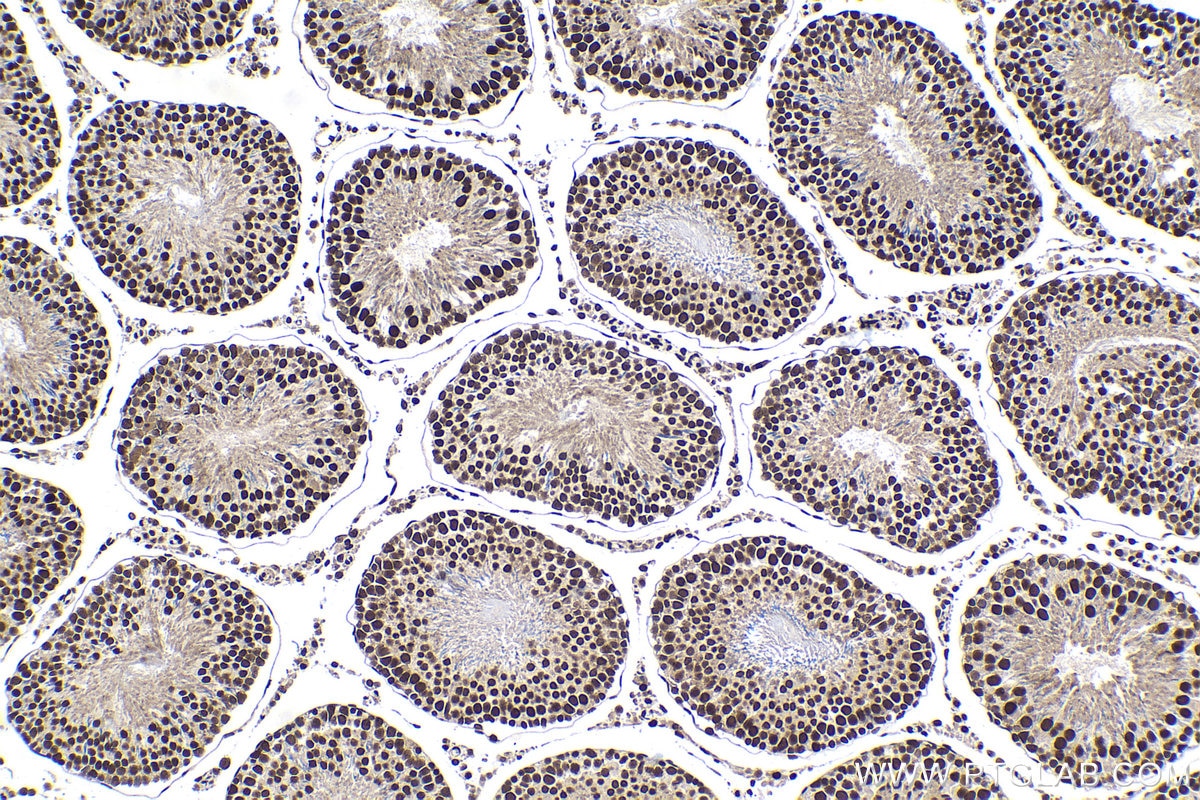 Immunohistochemical analysis of paraffin-embedded rat testis tissue slide using KHC1428 (TCERG1 IHC Kit).