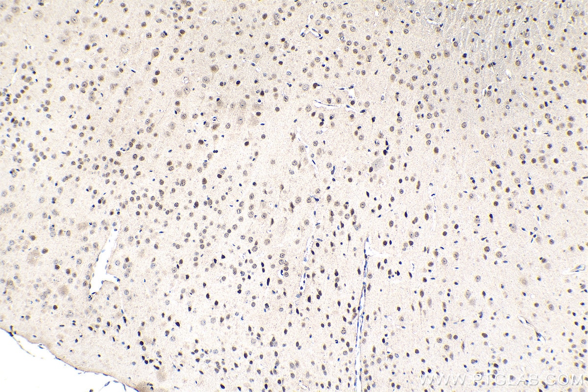 Immunohistochemical analysis of paraffin-embedded mouse brain tissue slide using KHC1536 (TCF4 IHC Kit).