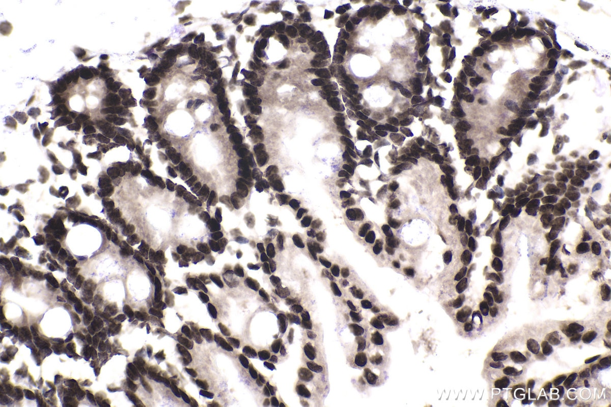 Immunohistochemical analysis of paraffin-embedded mouse small intestine tissue slide using KHC1958 (TCF4/TCF7L2 IHC Kit).
