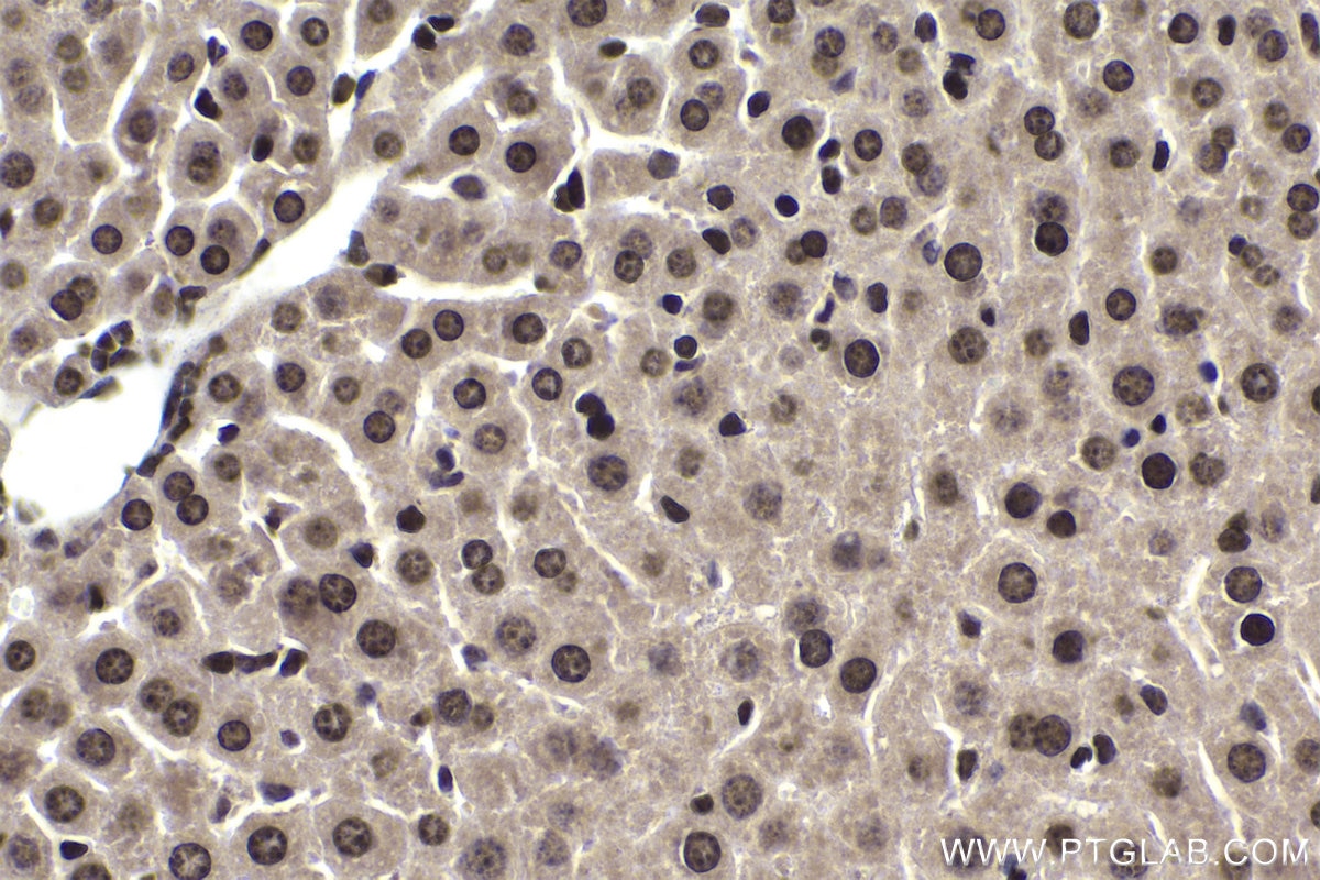 Immunohistochemical analysis of paraffin-embedded mouse liver tissue slide using KHC1958 (TCF4/TCF7L2 IHC Kit).